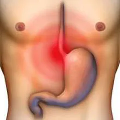 SỰ KHÁC BIỆT GIỮA CẢM GIÁC KHÓ CHỊU Ở DẠ DÀY VÀ Ợ CHUA LÀ GÌ?