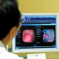 THÔNG TIN VỀ POLYP ĐẠI TRÀNG: NGUYÊN NHÂN, LÝ DO PHẪU THUẬT VÀ CÁCH PHÒNG NGỪA