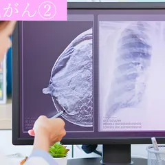 UNG THƯ VÚ - CĂN BỆNH PHỤ NỮ TRÊN 50 CẦN CHÚ Ý