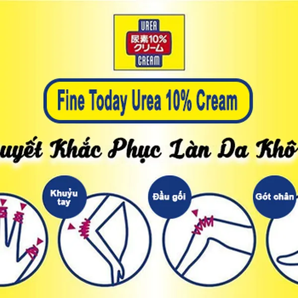 KEM TRỊ KHÔ NỨT DA TAY CHÂN  FINE TODAY UREA 10% CREAM
