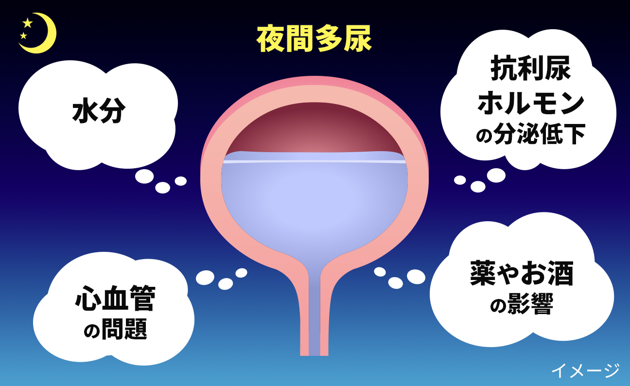 Tiểu Đêm Là Gì? Nguyên Nhân Và Cách Xử Lý Hiệu Quả Tiểu Đêm Là Gì? Nguyên Nhân Và Cách Xử Lý Hiệu Quả