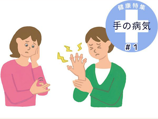 Tôi Đang Gặp Phải Tình Trạng Đau Nhức Ở Các Khớp Ngón Tay Tôi Đang Gặp Phải Tình Trạng Đau Nhức Ở Các Khớp Ngón Tay