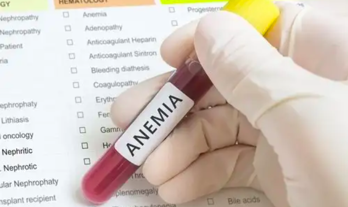 Triệu Chứng Do Thiếu Sắt Triệu Chứng Do Thiếu Sắt