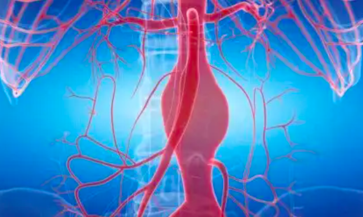 Về ảnh hưởng của huyết áp cao đối với cơ thể Về ảnh hưởng của huyết áp cao đối với cơ thể