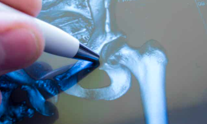 Nguyên Nhân Và Phương Pháp Điều Trị Viêm Khớp Tự Phát Ở Thiếu Niên Nguyên Nhân Và Phương Pháp Điều Trị Viêm Khớp Tự Phát Ở Thiếu Niên