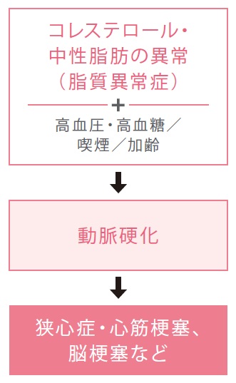 Xơ Cứng Động Mạch Do Cholesterol Siêu Xấu! Những Điều Cần Lưu Ý Đối Với Phụ Nữ Tuổi 50 Xơ Cứng Động Mạch Do Cholesterol Siêu Xấu! Những Điều Cần Lưu Ý Đối Với Phụ Nữ Tuổi 50