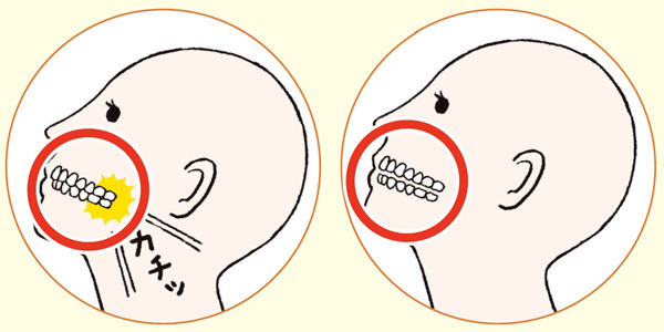 Xóa Bỏ Nếp Nhăn Trên Khuôn Mặt, Bàn Tay Và Cổ Lão Hóa Cùng Một Lúc! Xóa Bỏ Nếp Nhăn Trên Khuôn Mặt, Bàn Tay Và Cổ Lão Hóa Cùng Một Lúc!