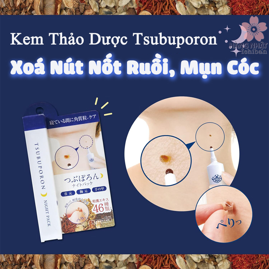 Kem Thảo Dược Xóa Nốt Ruồi, Mụn Cóc Tsubuporon Kem Thảo Dược Xóa Nốt Ruồi, Mụn Cóc Tsubuporon