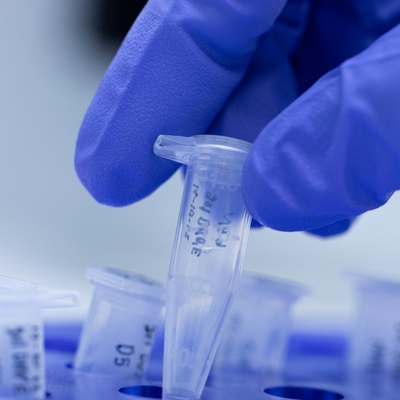 DỊCH VỤ XÉT NGHIỆM PCR CÁC BỆNH PHỔ BIẾN TRONG CHĂN NUÔI