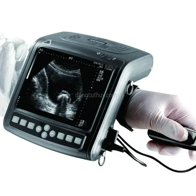 MÁY SIÊU ÂM THAI CHO BÒ KX5200 CAO CẤP, CHO KẾT QUẢ NGAY - CHÍNH XÁC