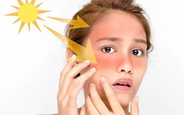 Bí quyết chăm sóc da mùa hè không bắt nắng