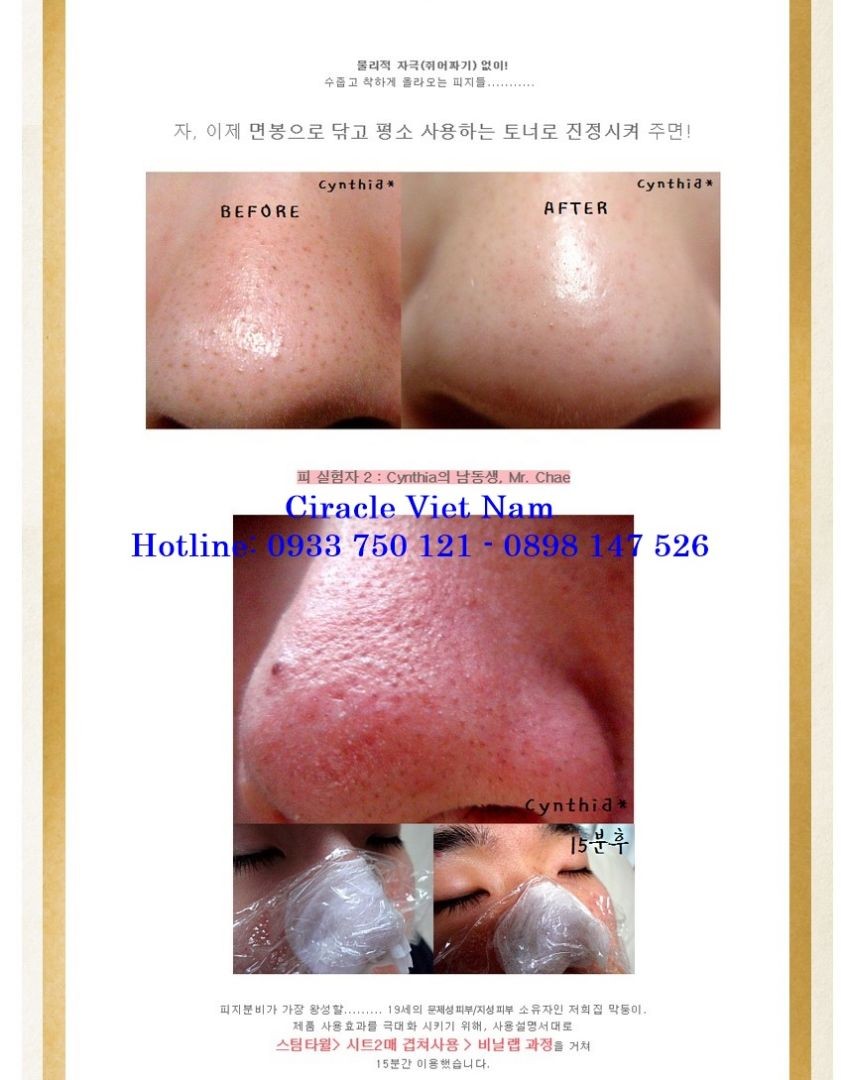Miếng dán đẩy mụn đầu đen Ciracle PORE CONTROL BLACKHEAD OFF SHEET
