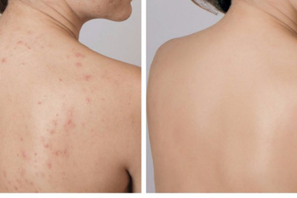 xà bông tự nhiên xà bông tự nhiên