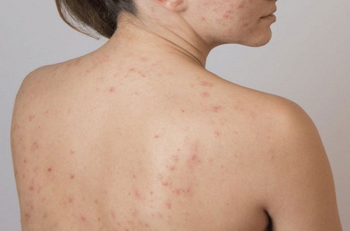 tác dụng của xà bông dừa tác dụng của xà bông dừa