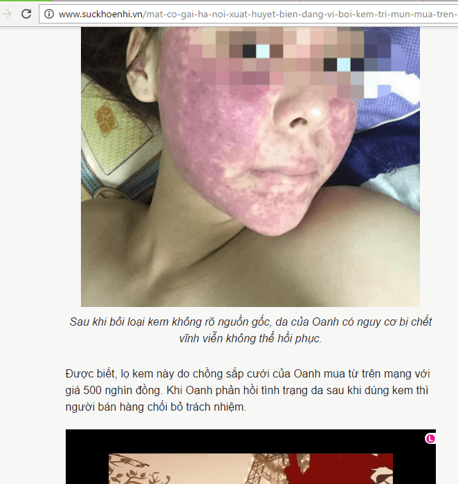 Thuốc Trị Mụn Thanh Trang Có Nguồn Gốc Xuất Xứ Rõ Ràng Không? Thuốc Trị Mụn Thanh Trang Có Nguồn Gốc Xuất Xứ Rõ Ràng Không?