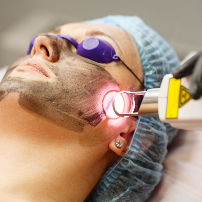 “Laser tái tạo da – Hiệu quả nhanh nhưng cần chuyên môn cao.” Laser tác động sâu vào lớp da, giúp xóa mờ vết thâm, nếp nhăn và kích thích sản sinh collagen.