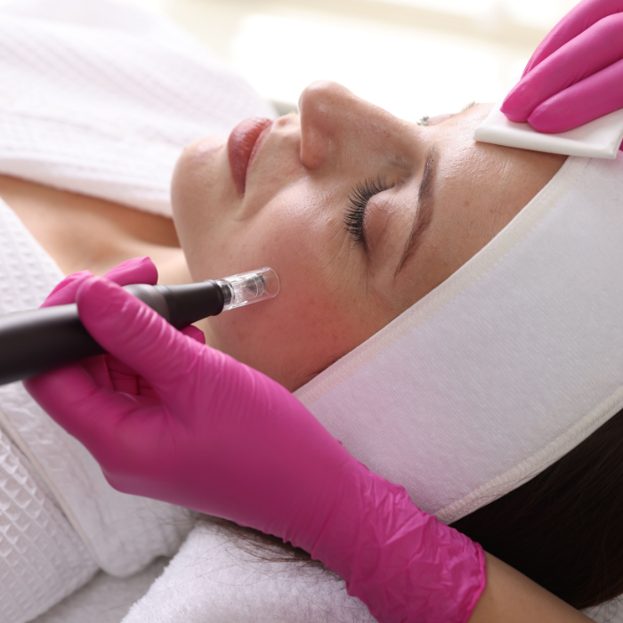 “Mesotherapy – Dưỡng chất thấm sâu, da khỏe và căng mịn.” Tiêm dưỡng chất cung cấp trực tiếp vitamin và độ ẩm cho da, giúp da sáng mịn và căng bóng.