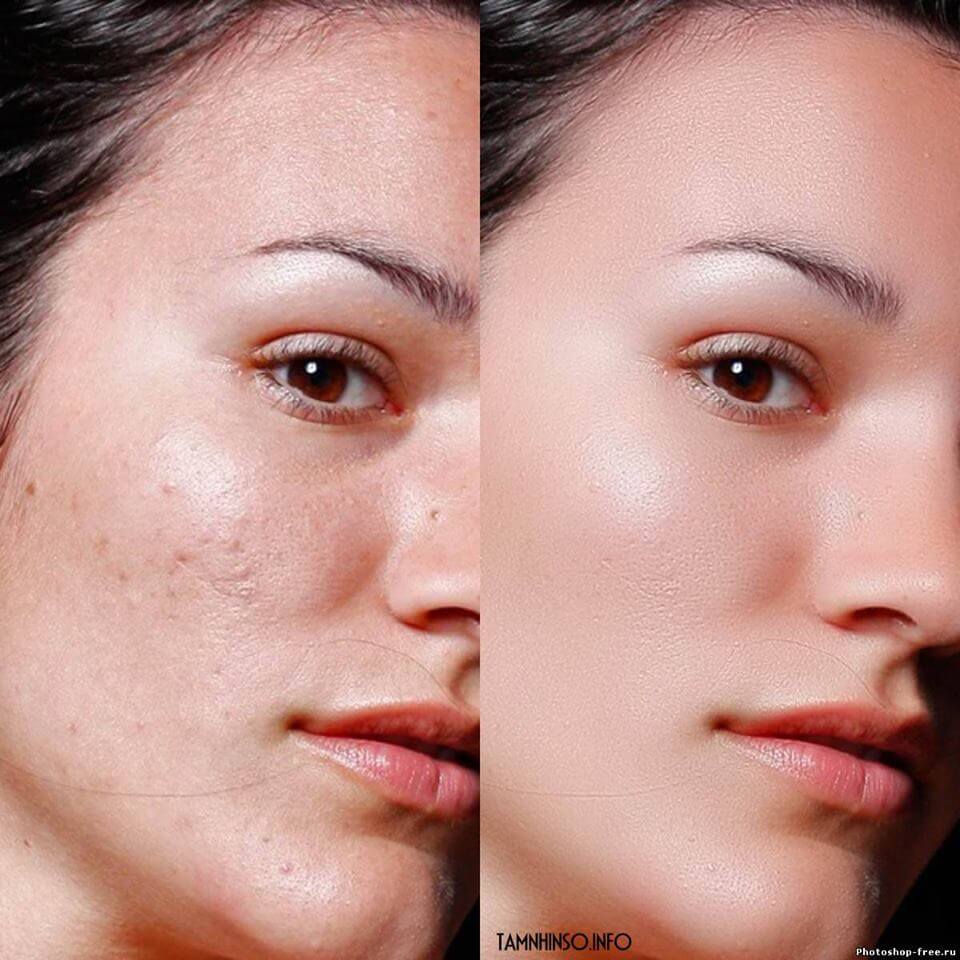 Cách tẩy tế bào chết trên da mặt bằng đông y Thanh Trang Cách tẩy tế bào chết trên da mặt bằng đông y Thanh Trang