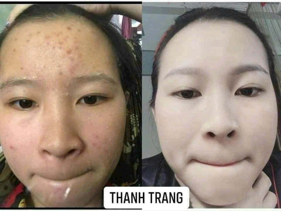 Mặt được: Lợi ích khi tái tạo da Những lợi ích chính mà quá trình tái tạo da mang lại.”