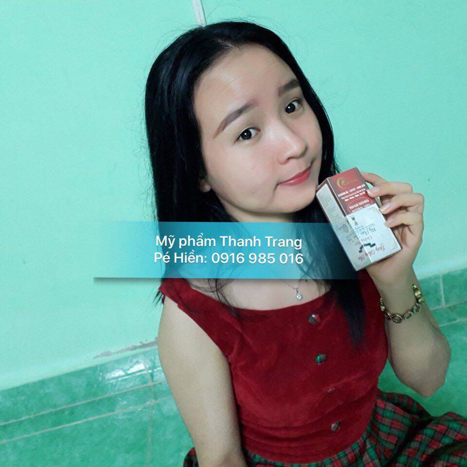 Dung dịch tái tạo da Thanh Trang: Sản phẩm tuyệt vời giúp da hết mụn Dung dịch tái tạo da Thanh Trang: Sản phẩm tuyệt vời giúp da hết mụn