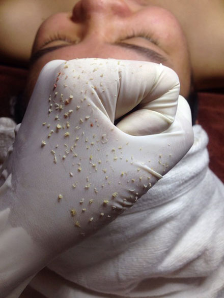 hướng dẫn bạn dùng dung dịch mụn nám Thanh Trang hướng dẫn bạn dùng dung dịch mụn nám Thanh Trang