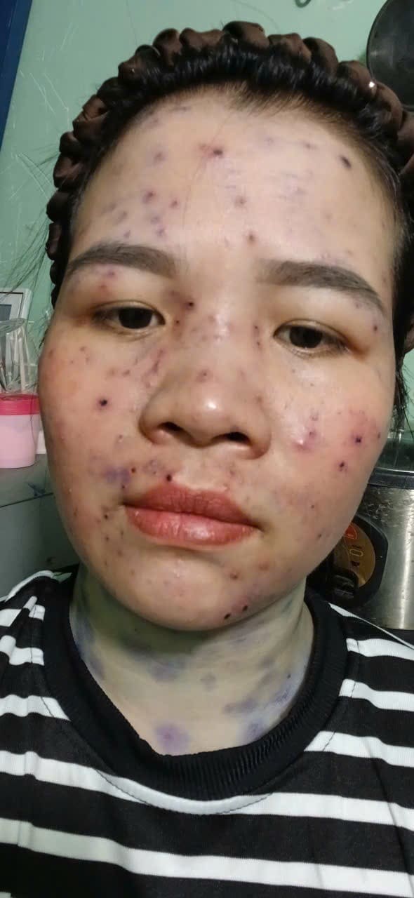 Khách hàng thủy đậu