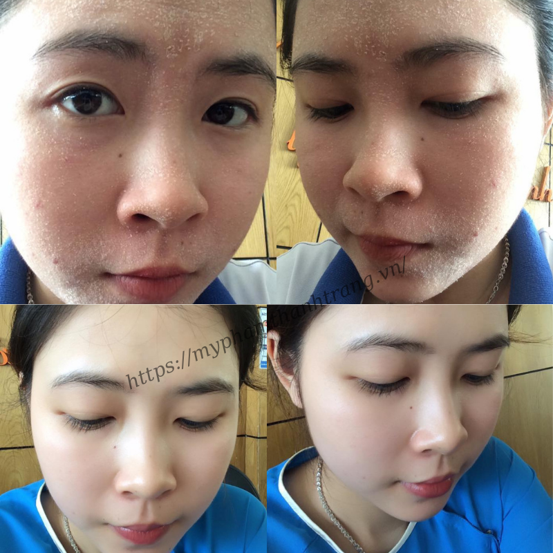 khi nào nên ngưng bôi mỹ phẩm Thanh Trang tái tạo da khi nào nên ngưng bôi mỹ phẩm Thanh Trang tái tạo da