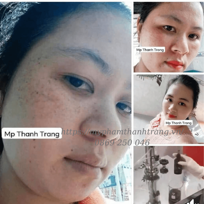 khi nào nên ngưng bôi mỹ phẩm Thanh Trang tái tạo da khi nào nên ngưng bôi mỹ phẩm Thanh Trang tái tạo da