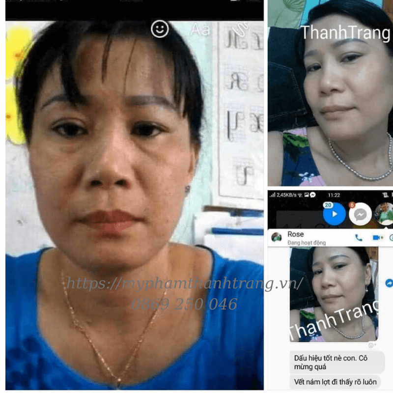 khi nào nên ngưng bôi mỹ phẩm Thanh Trang tái tạo da khi nào nên ngưng bôi mỹ phẩm Thanh Trang tái tạo da