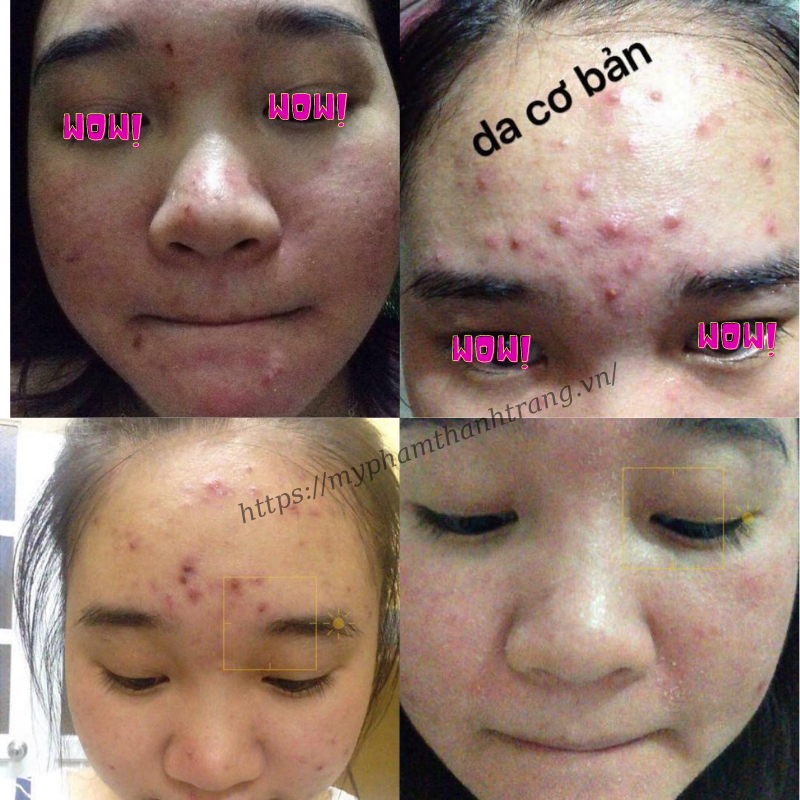 Mẹ Bầu Có Được Sử Dụng Tái Tạo Da Thanh Trang Mẹ Bầu Có Được Sử Dụng Tái Tạo Da Thanh Trang