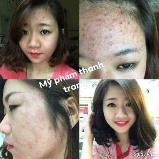 Mỹ phẩm Thanh Trang giá bao nhiêu và có đáng để bạn sở hữu? Mỹ phẩm Thanh Trang giá bao nhiêu và có đáng để bạn sở hữu?