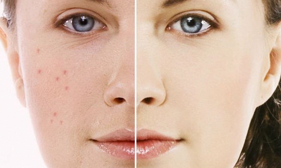 Cách tái tạo da mặt tại nhà bằng thảo dược đông y Thanh Trang Cách tái tạo da mặt tại nhà bằng thảo dược đông y Thanh Trang