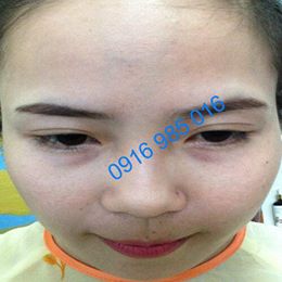 Pé Hiền Tái Tạo Da Bằng Thảo Dược Trị Mụn Thanh Trang Pé Hiền Tái Tạo Da Bằng Thảo Dược Trị Mụn Thanh Trang