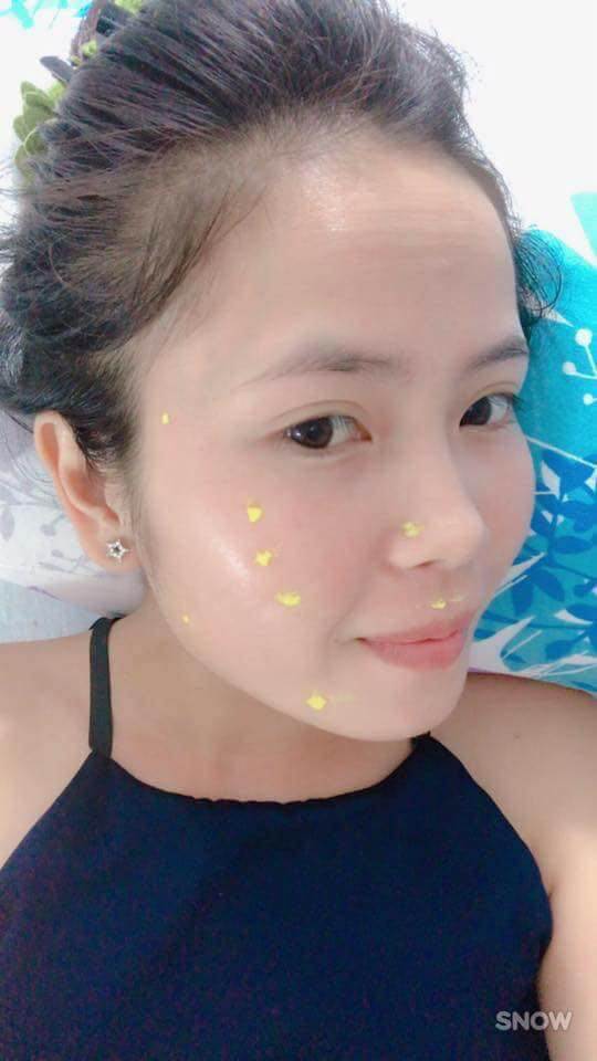 Pé Hiền Tái Tạo Da Bằng Thảo Dược Trị Mụn Thanh Trang Pé Hiền Tái Tạo Da Bằng Thảo Dược Trị Mụn Thanh Trang