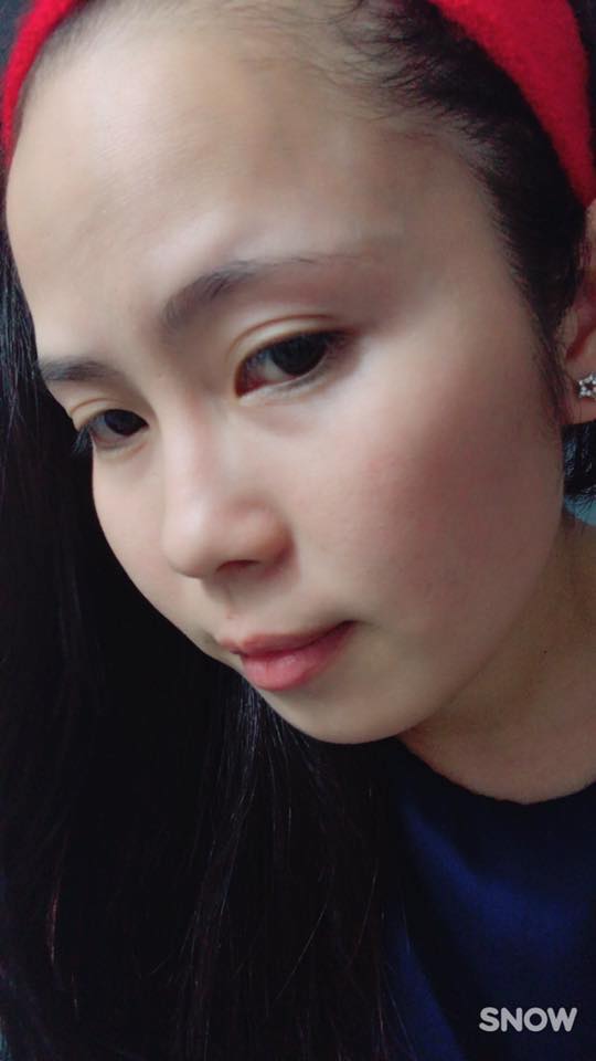 Pé Hiền Tái Tạo Da Bằng Thảo Dược Trị Mụn Thanh Trang Pé Hiền Tái Tạo Da Bằng Thảo Dược Trị Mụn Thanh Trang