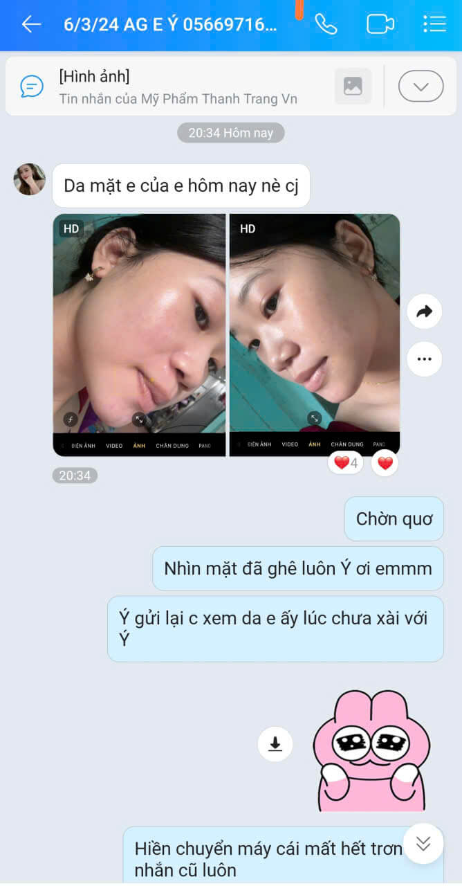 Phản hồi khách hàng xài Linh Chi Vi Mụn Phản hồi khách hàng xài Linh Chi Vi Mụn