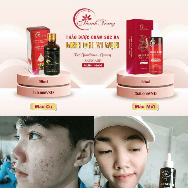 Không bào mòn da – Không ép da đẹp gấp – Không chạy theo treatment mạnh. Tái tạo da là hành trình nuôi dưỡng nền da khỏe để da tự đẹp theo thời gian. Triết lý tái tạo da bền vững của Thanh Trang