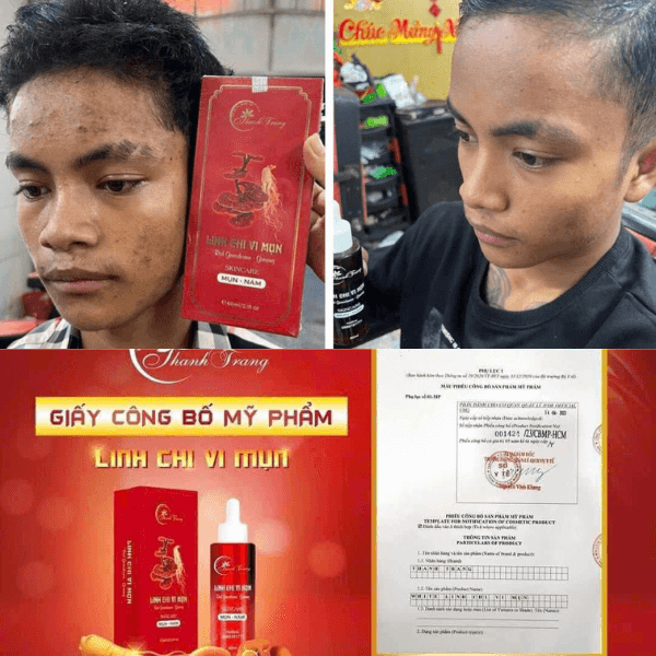 Hàng rào bảo vệ da giúp da giữ ẩm, chống vi khuẩn và tự phục hồi. Khi hàng rào da suy yếu, tái tạo da trở nên chậm và kém hiệu quả. Hàng rào bảo vệ da – Gốc rễ của quá trình tái tạo da