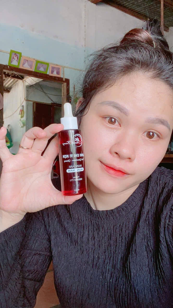 Tái tạo da bao lâu da sẽ đẹp Tái tạo da bao lâu da sẽ đẹp