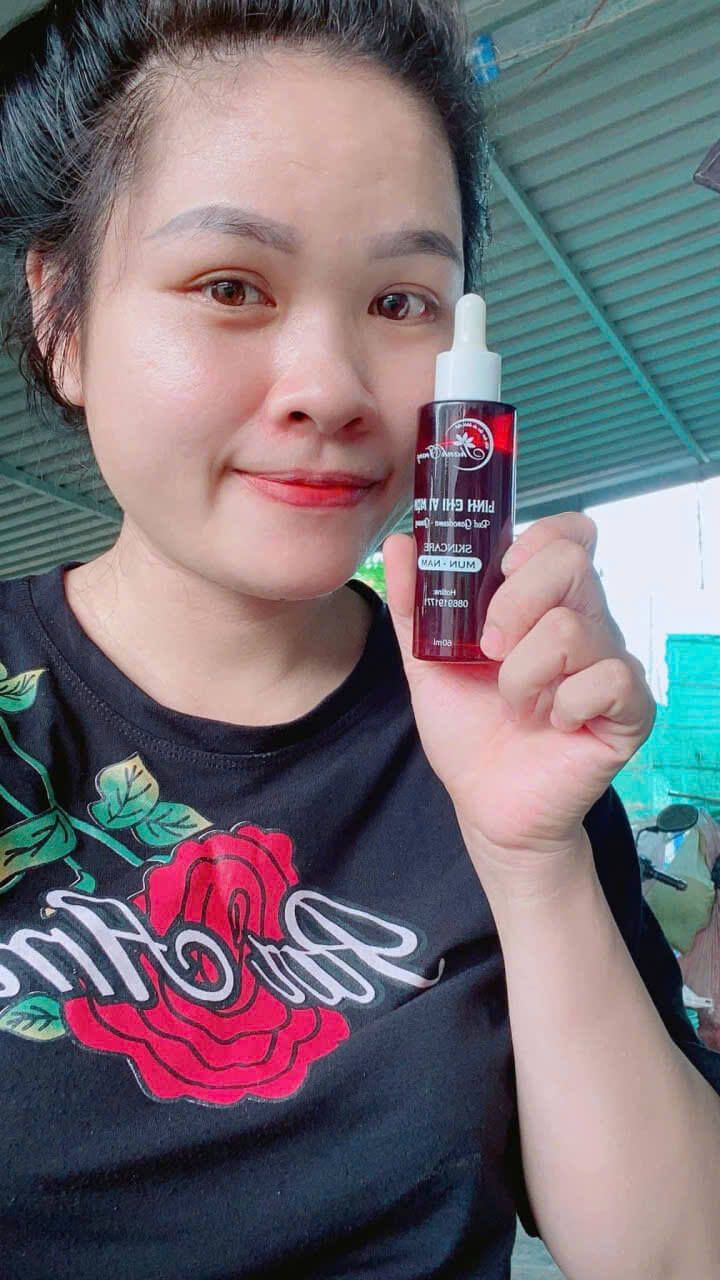 Tái tạo da bao lâu da sẽ đẹp Tái tạo da bao lâu da sẽ đẹp