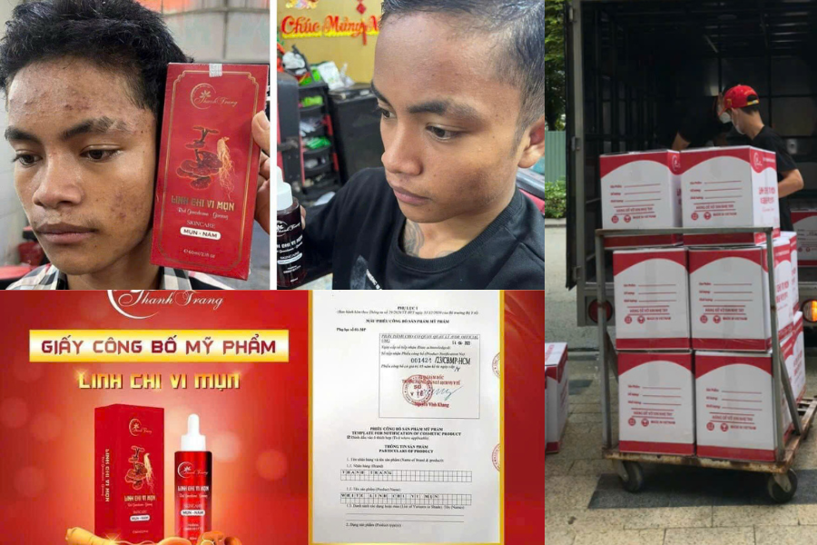 Tái Tạo Da Đón Tết Tái Tạo Da Đón Tết