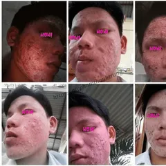 Phản Hồi Khách Hàng Dùng Tái Tạo Da Mỹ Phẩm Thanh Trang