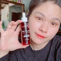 Tái tạo da bao lâu thì đẹp?