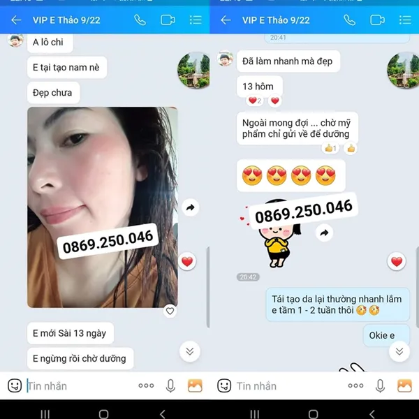 Thảo Dược Tái Tạo Da Linh Chi Vi Mụn