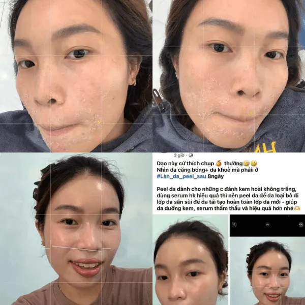 Hybrid Peptide Bio – Serum Phục Hồi & Dưỡng Ẩm Chuyên Sâu