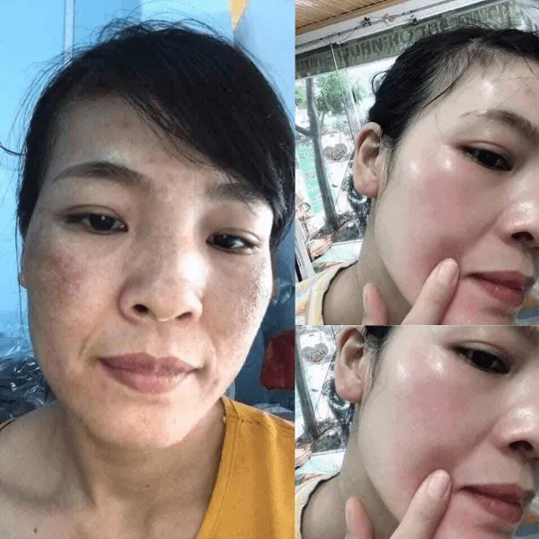 Meso Cream Chanbou – Kem Phục Hồi, Cấp Ẩm, Căng Bóng Ban Đêm