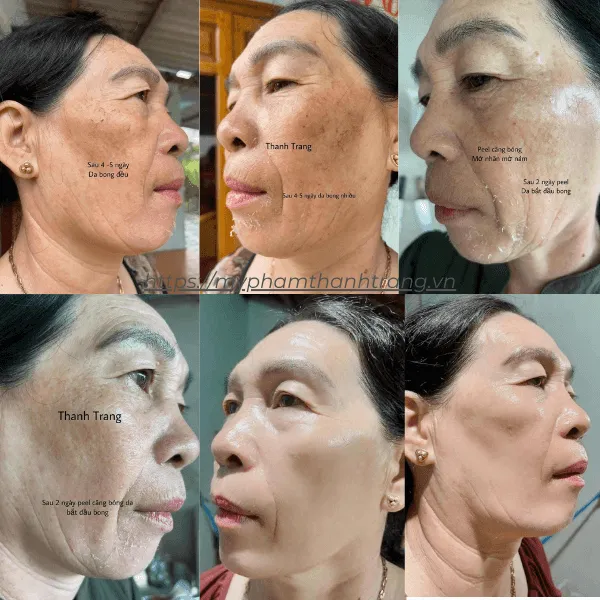 Hybrid Peptide Bio – Serum Phục Hồi & Dưỡng Ẩm Chuyên Sâu