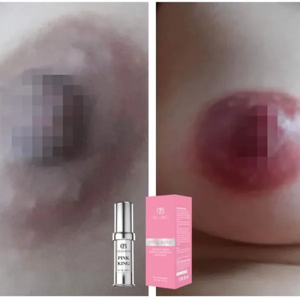 Kem Làm Hồng Nhũ Hoa & Bikini Pink King Chanbou