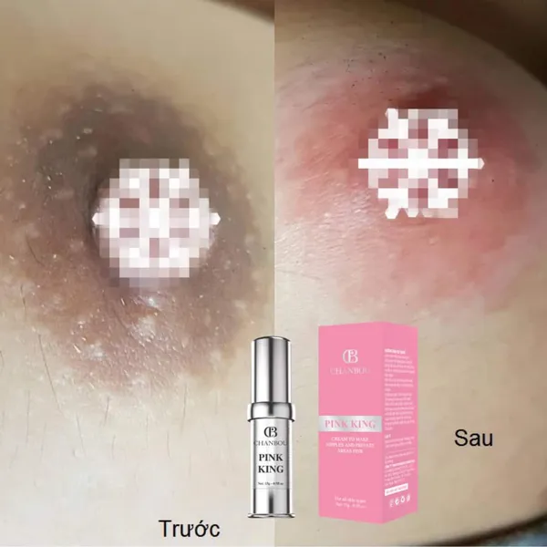 Kem Làm Hồng Nhũ Hoa & Bikini Pink King Chanbou