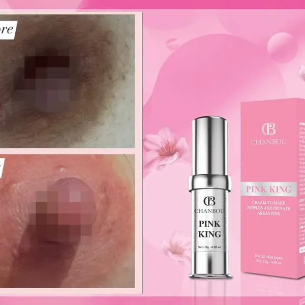 Kem Làm Hồng Nhũ Hoa & Bikini Pink King Chanbou
